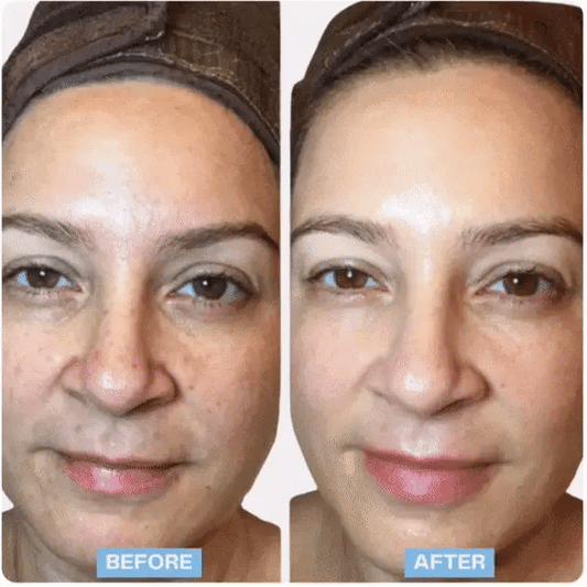 Face Massager Firming Wrinkle Removal