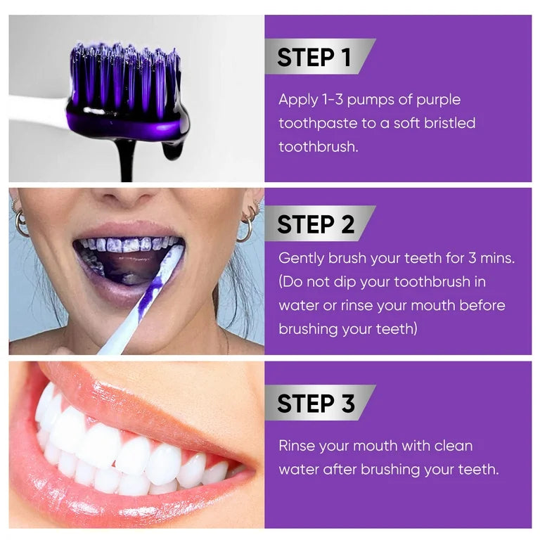 V34 Teeth Whitening