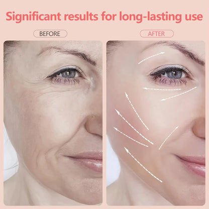 Face Massager Firming Wrinkle Removal